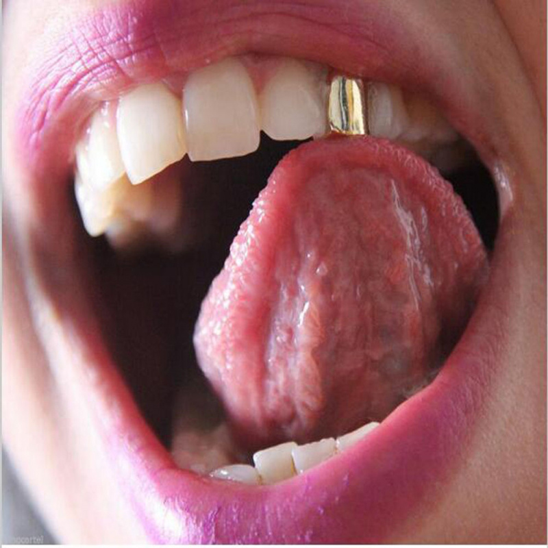 Neue 1-3 Stück Einzelzahnkappe – Body Jewelry Gold Plated Bewertung und Preis